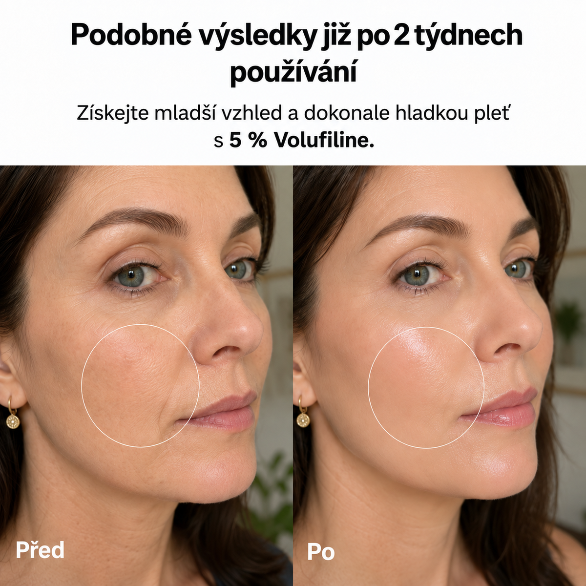 VoluFine | Korejské kolagenové sérum pro zralou pleť